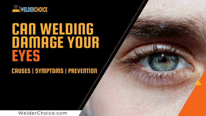 Can-Welding-Damage-Your -Eyes