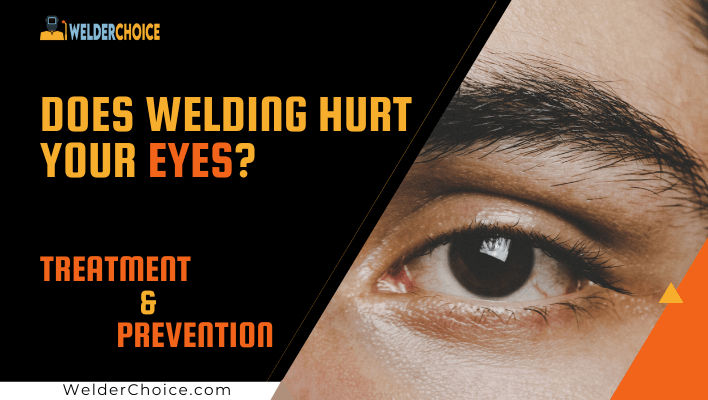 Does Welding Hurt Your Eyes